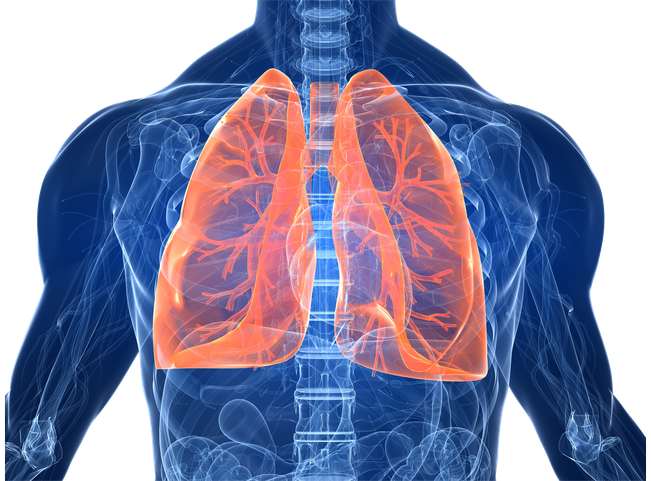 VIDA Diagnostics gives pulmonary diseases the big data treatment