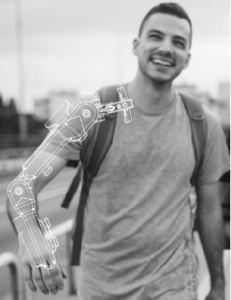 Picture of person with drawn over device on right arm